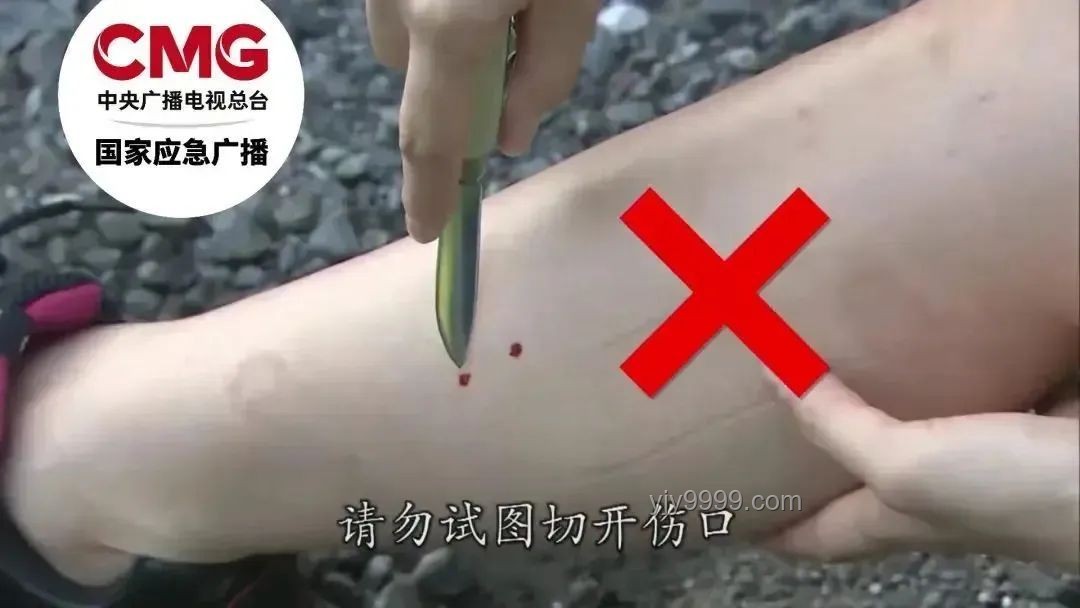 三亚旅游安全漏洞：游客被不明物咬伤身亡事件深度剖析